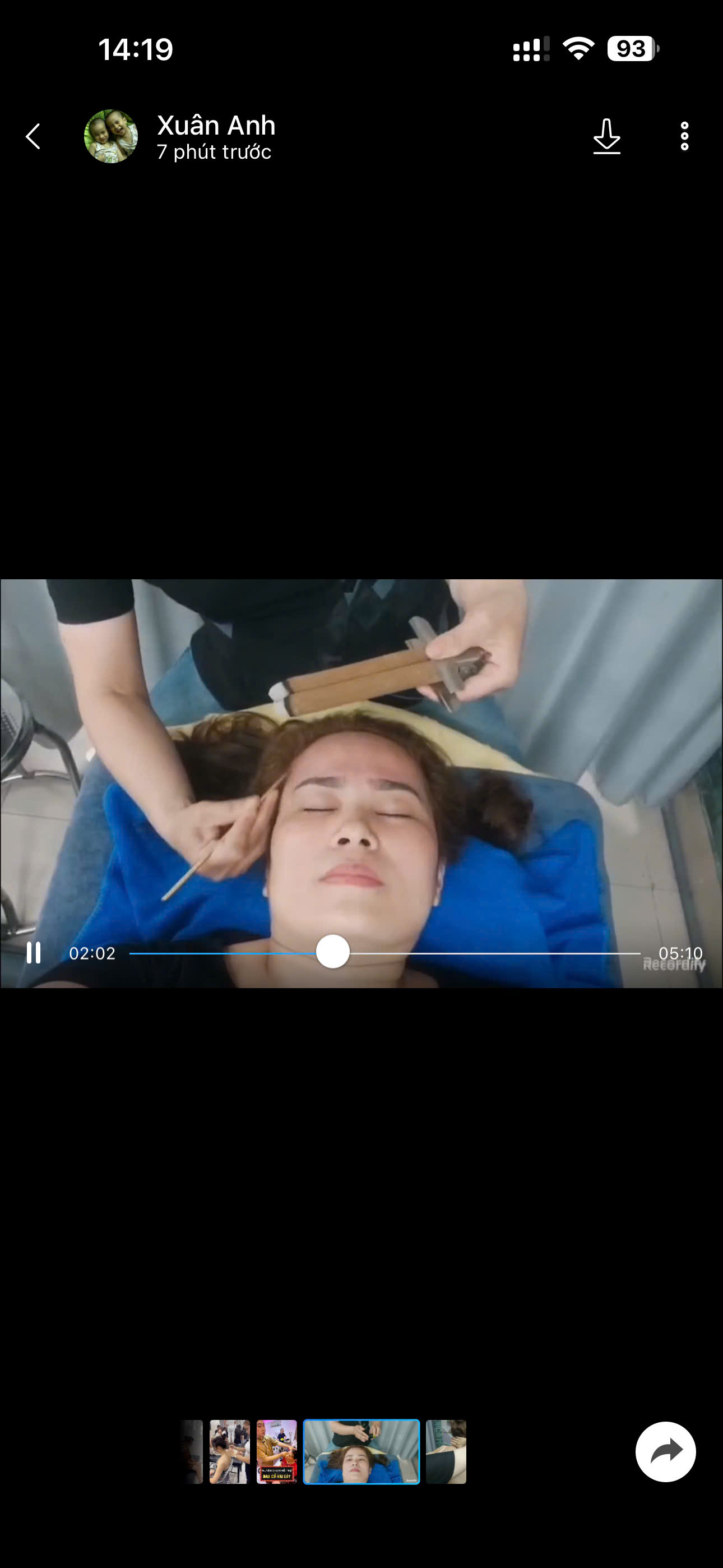 tri lieu bam huyet – huyen cham